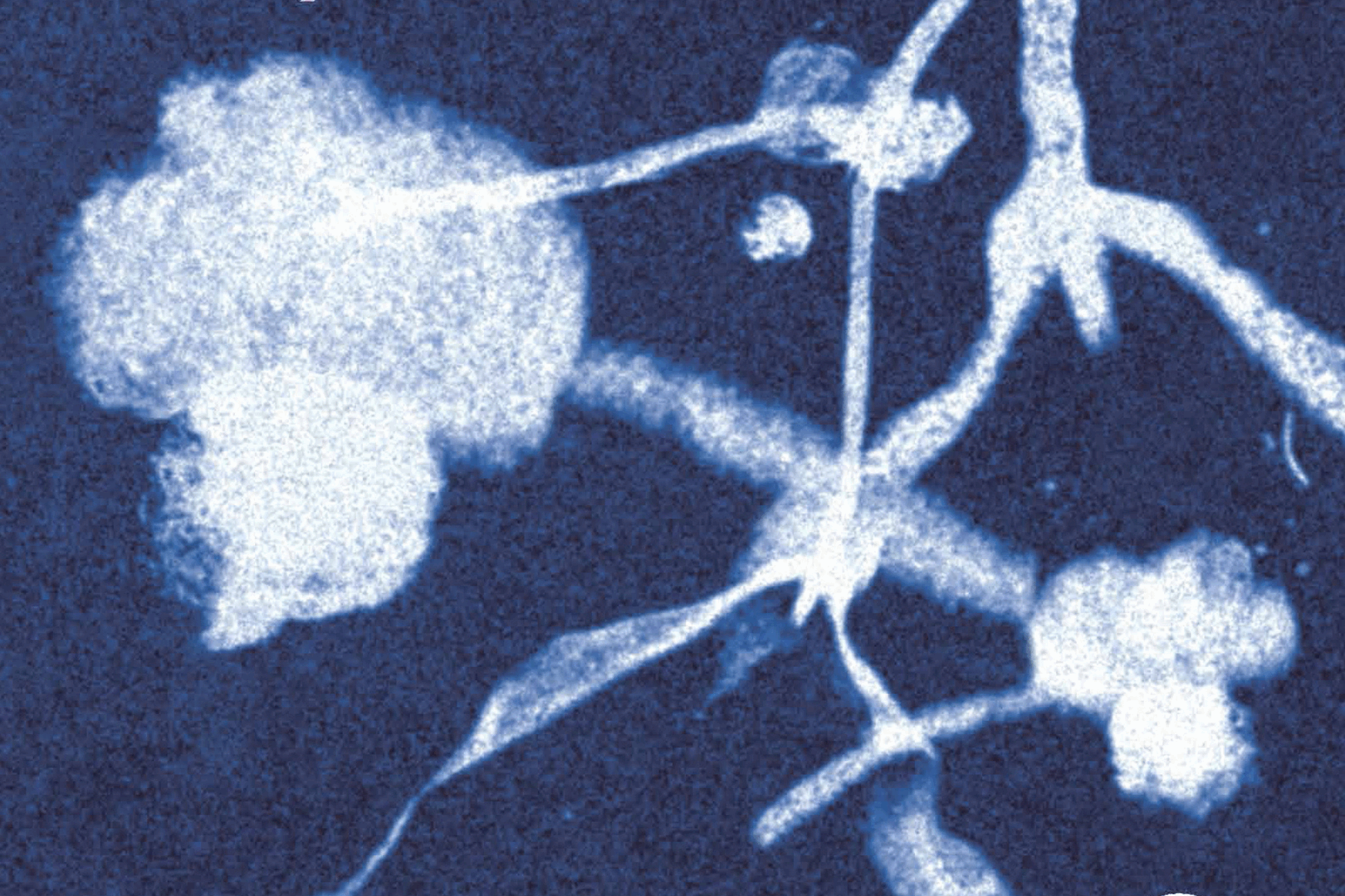 Nieuw boek 'Het ongemak van een lichaam' door oud-WOLKER Corinne Heyrman en Jante Wortel